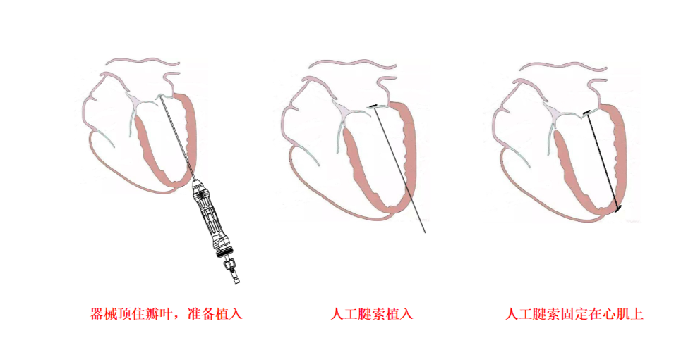 屏幕快照 2021-05-30 下午8.32.00.png
